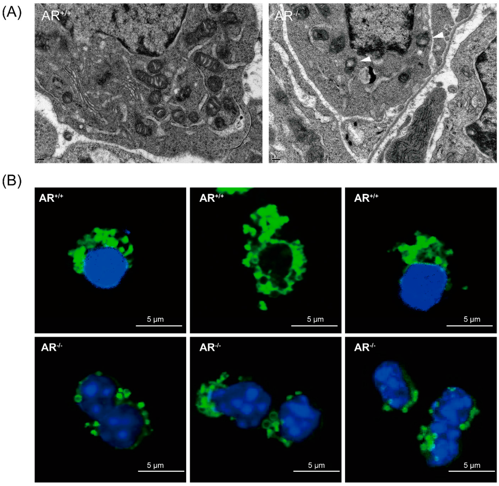 Ijms 16 09831 g004 1024