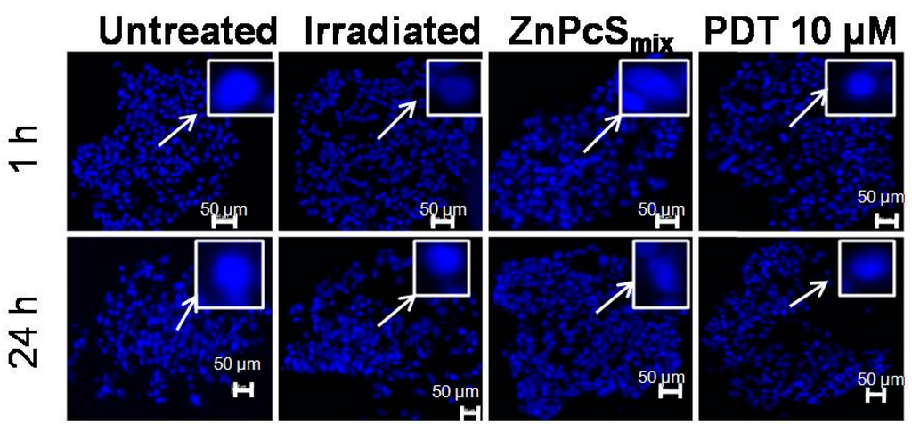 Ijms 16 10185 g005 1024