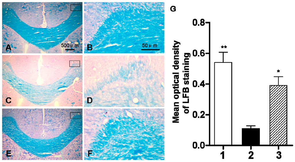 Ijms 16 10457 g007 1024