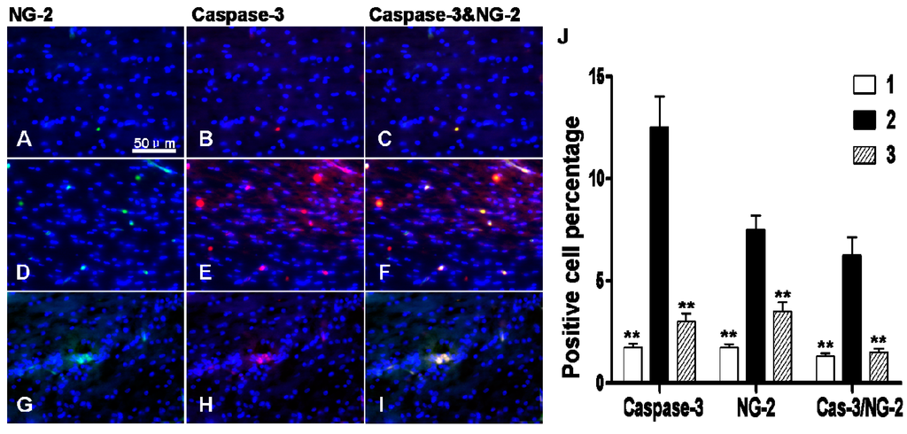 Ijms 16 10457 g009 1024