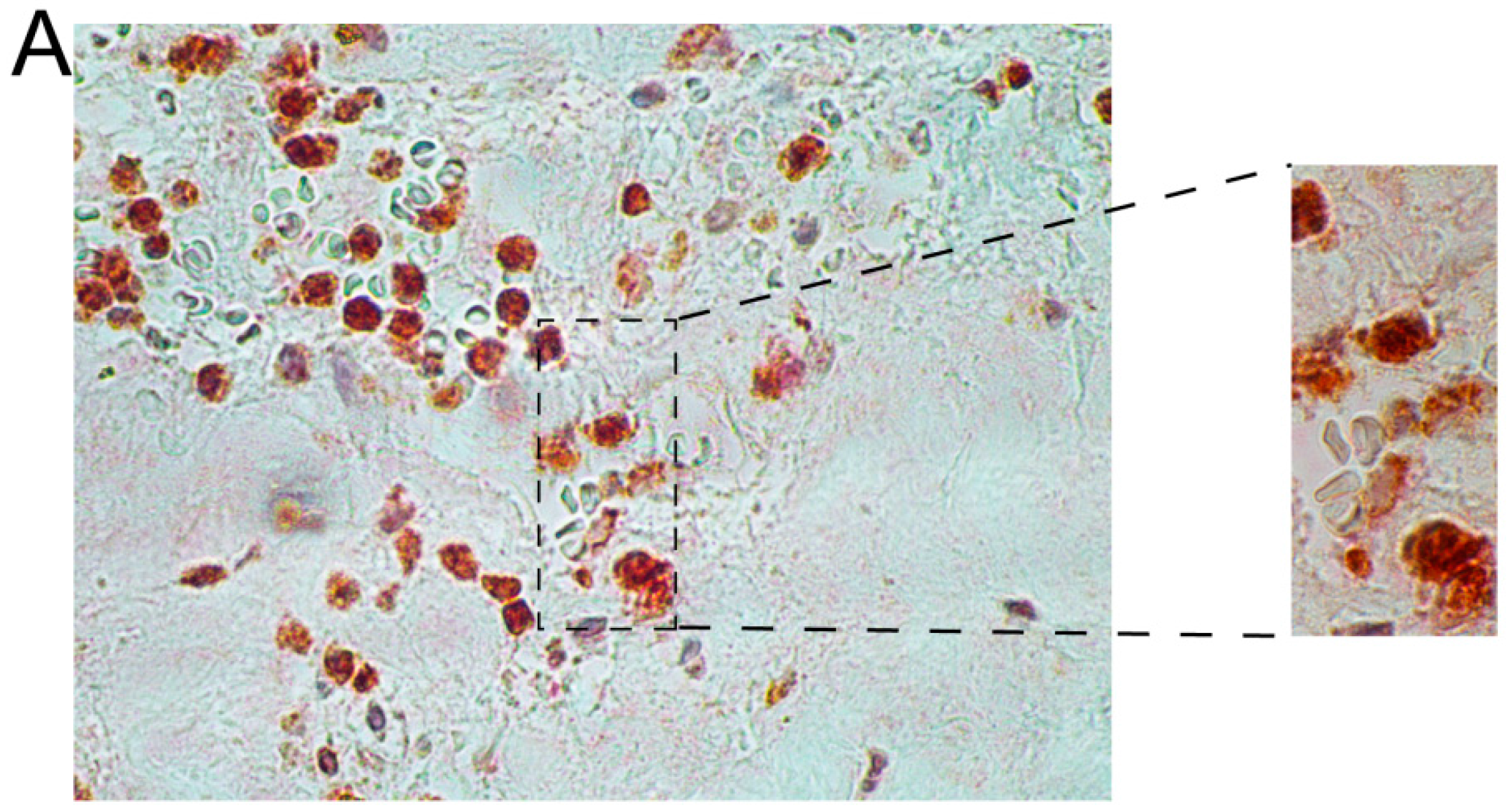 Ijms 16 11196 g003a