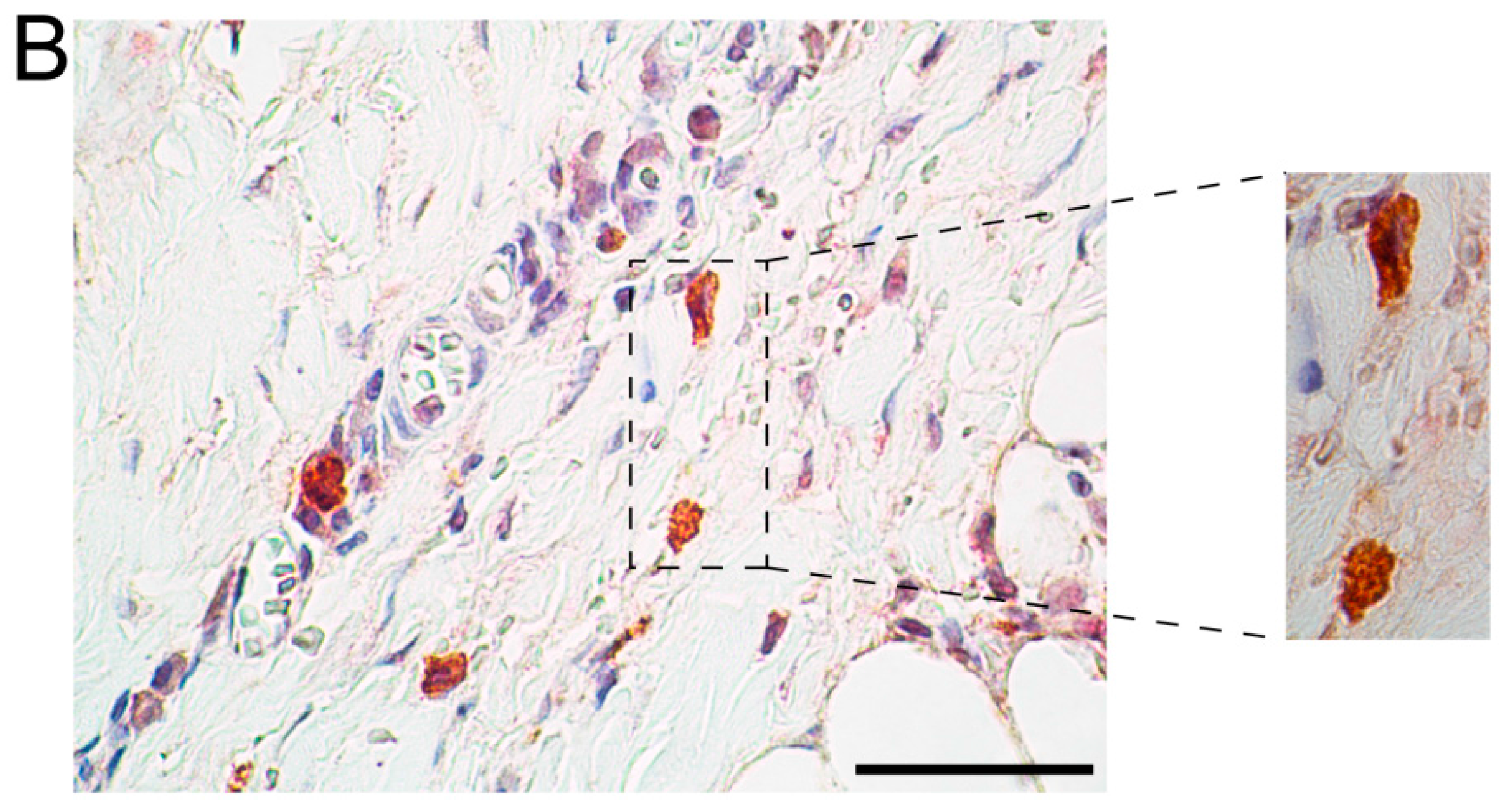 Ijms 16 11196 g003b
