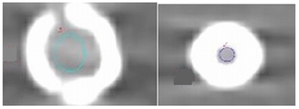 Ijms 16 11531 g007 1024