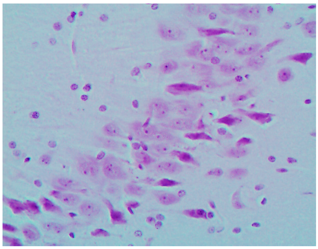 Ijms 16 22555 g006 1024