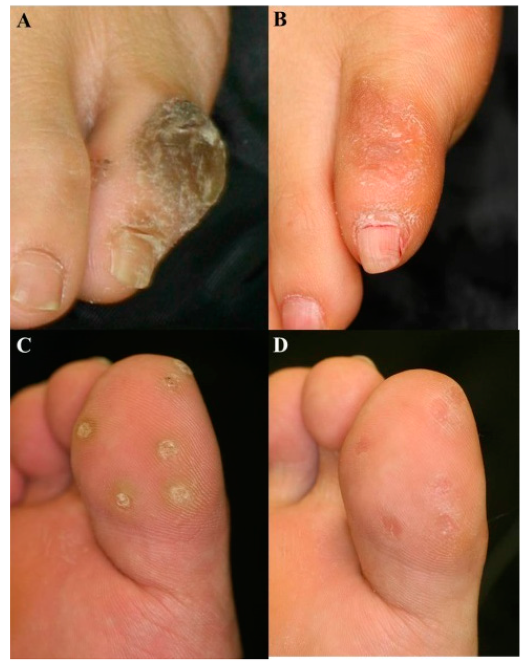 Ijms 16 23259 g003 1024