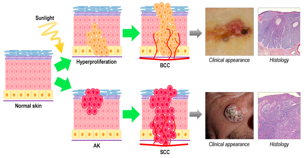 Ijms 16 25912 g001 1024