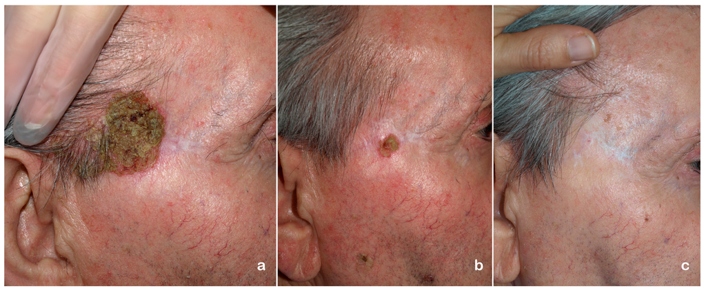 Ijms 16 25912 g003 1024