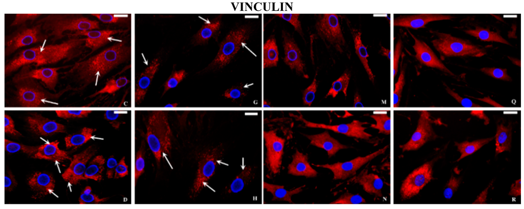 Ijms 16 25936 g005b 1024