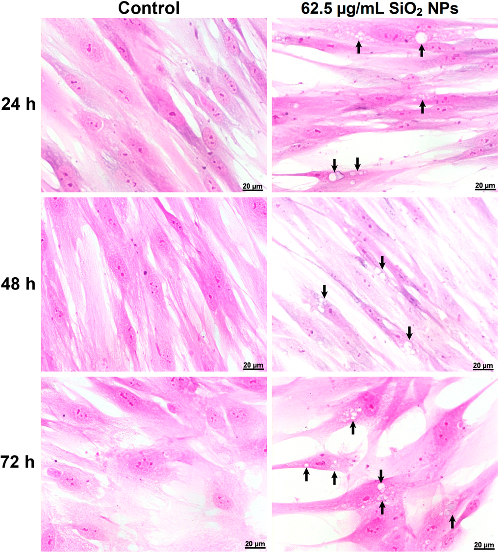 Ijms 16 26171 g003 1024