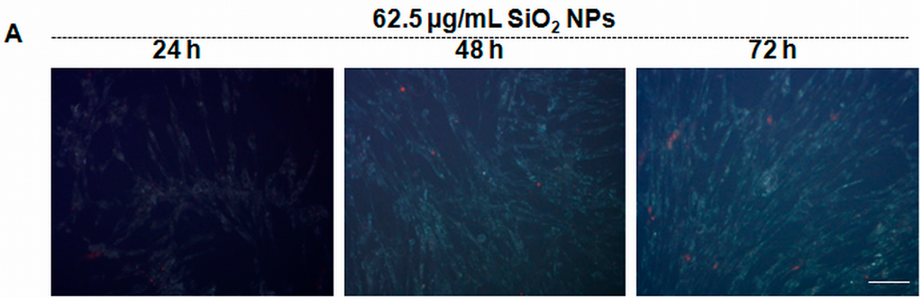 Ijms 16 26171 g008a 1024