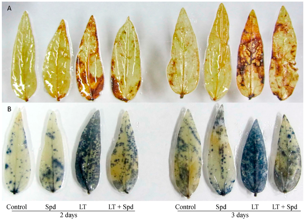 Ijms 16 26220 g002 1024