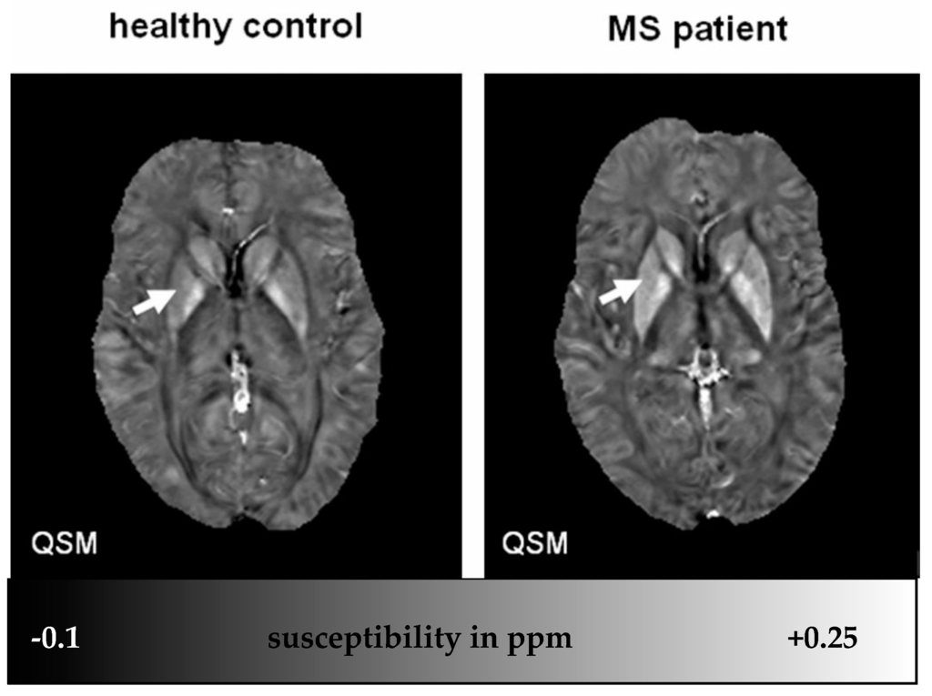 Ijms 17 00100 g002 1024