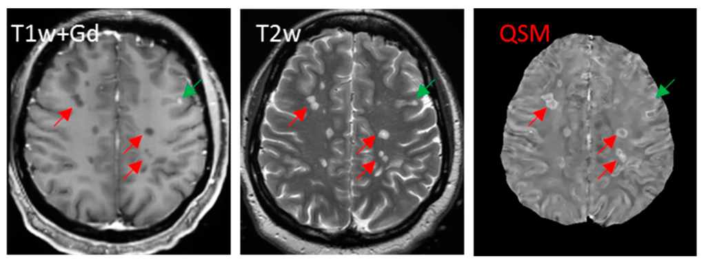 Ijms 17 00100 g006 1024