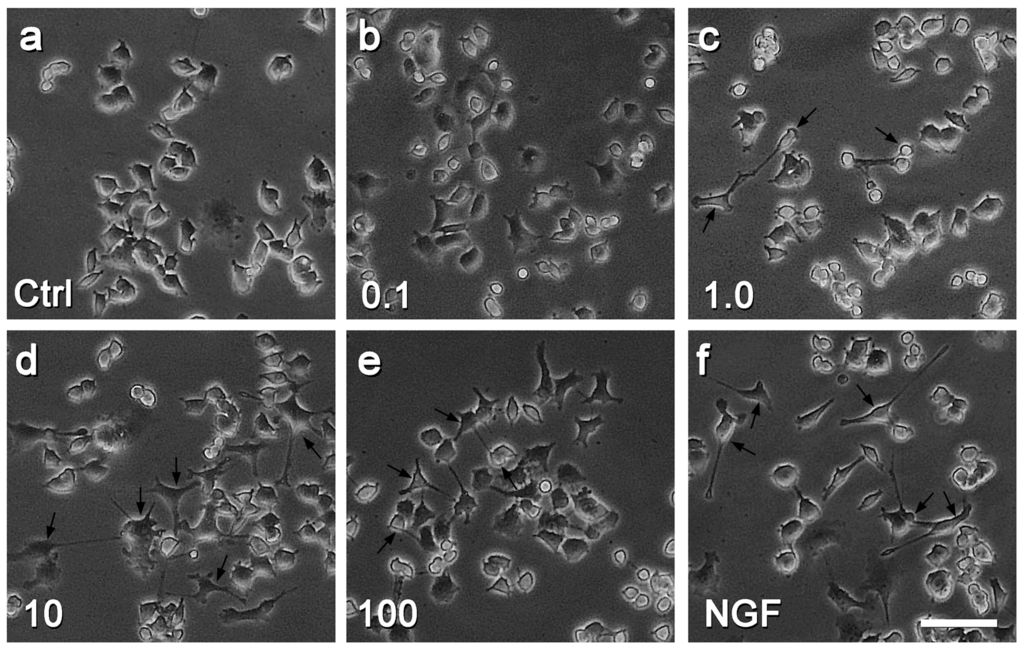 Ijms 17 00177 g002 1024