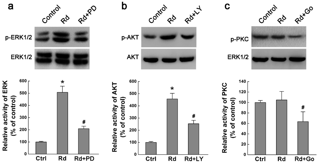 Ijms 17 00177 g004 1024