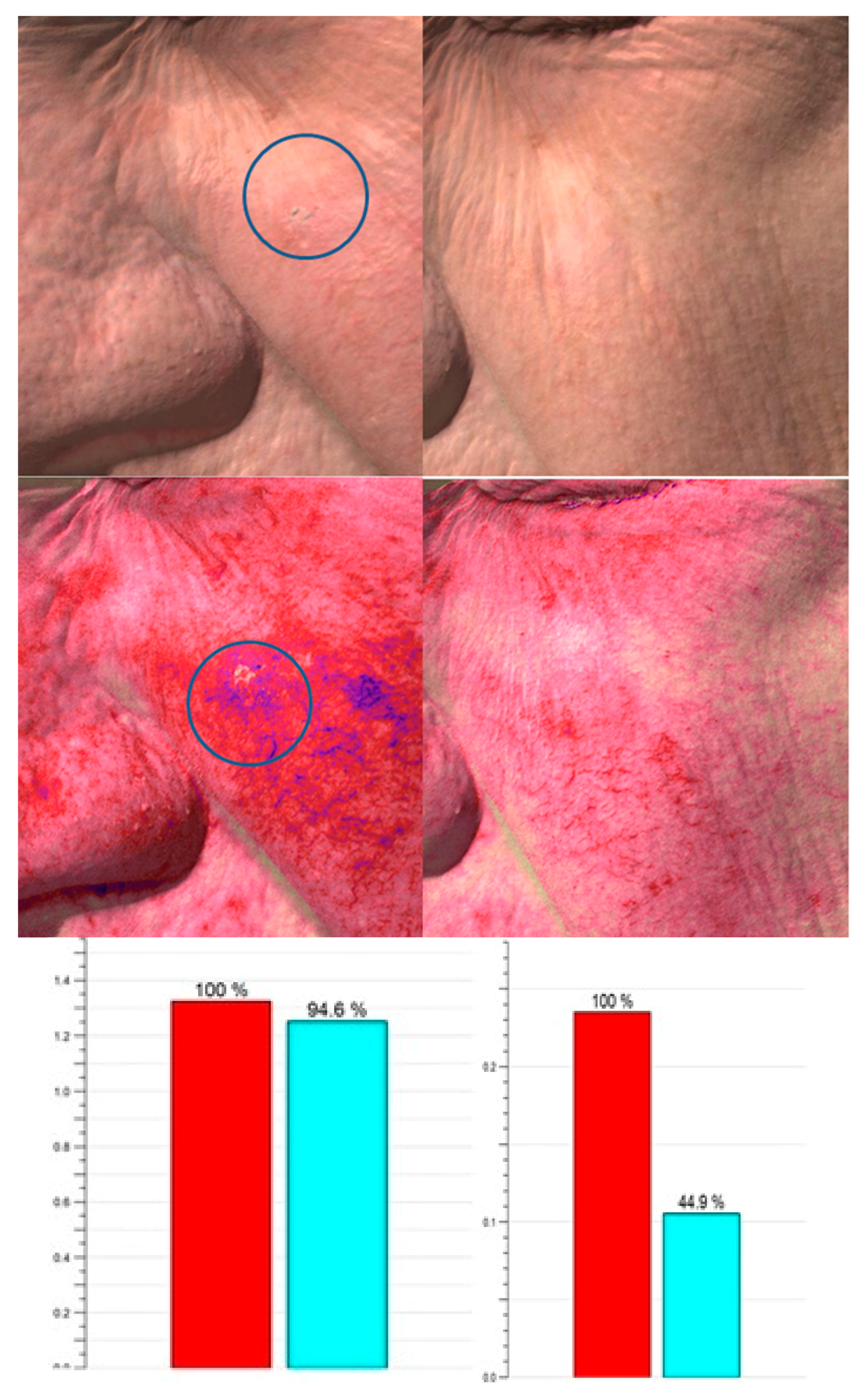 Ijms 17 01108 g003