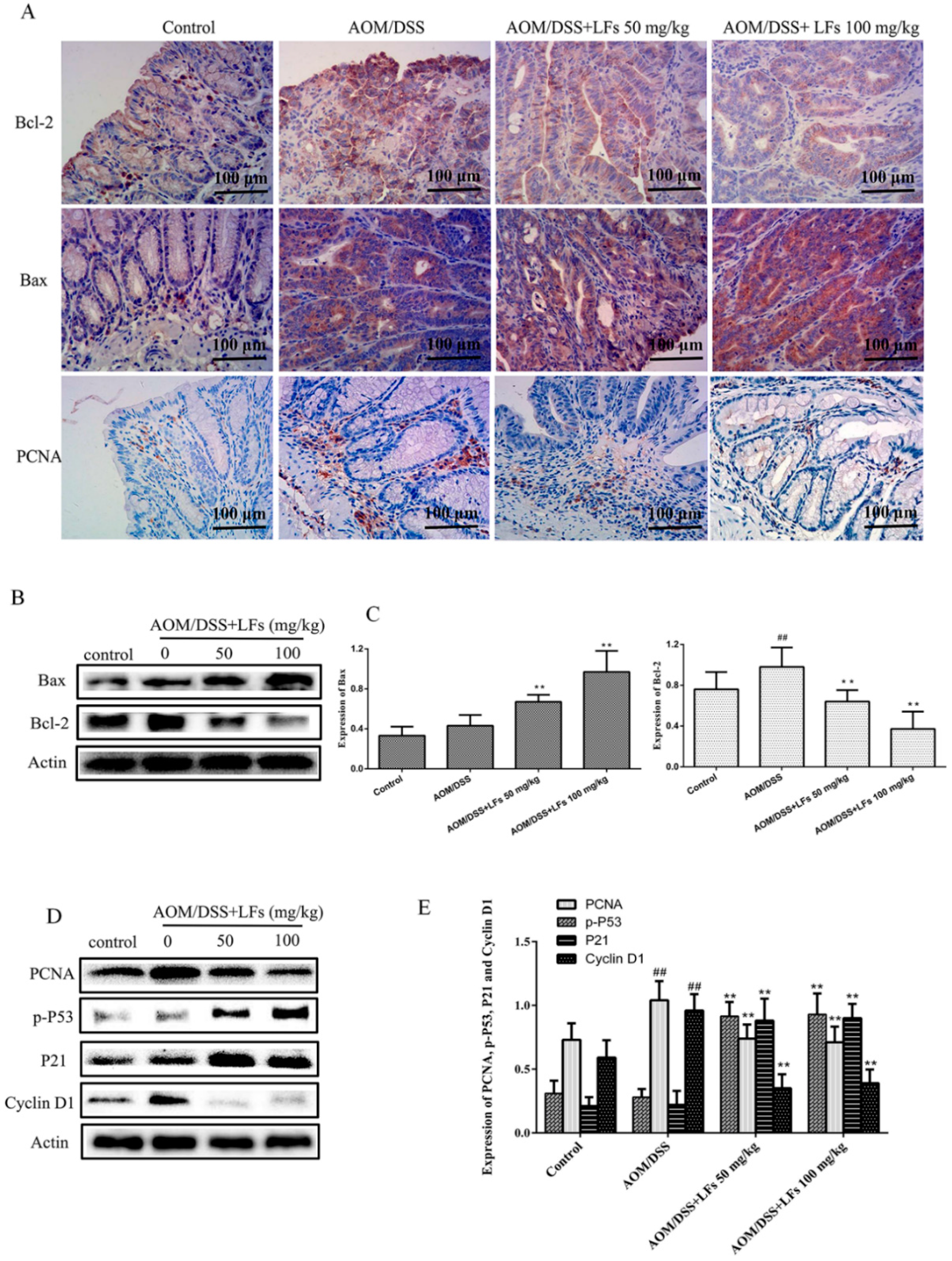 Ijms 17 01343 g003