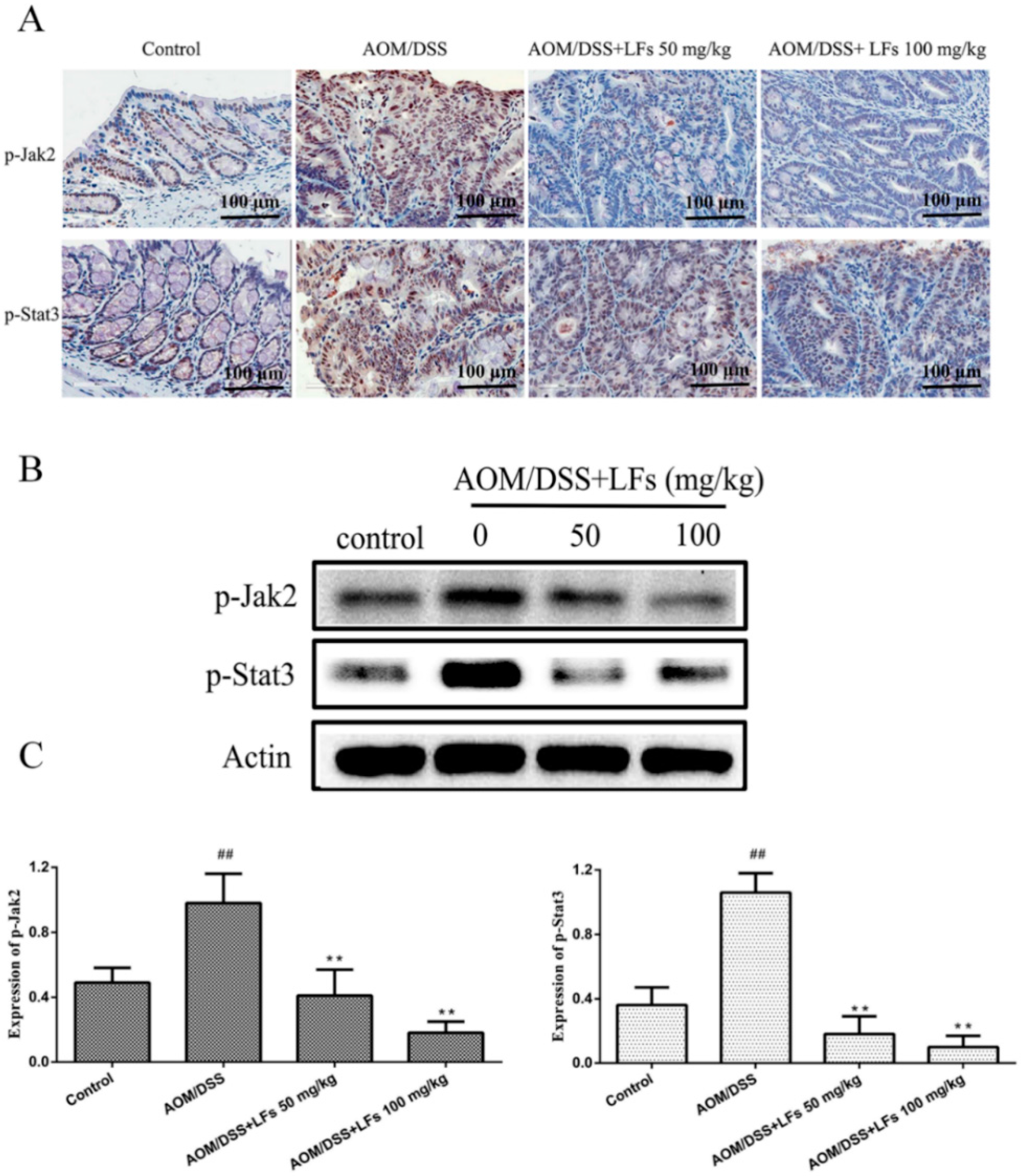 Ijms 17 01343 g005
