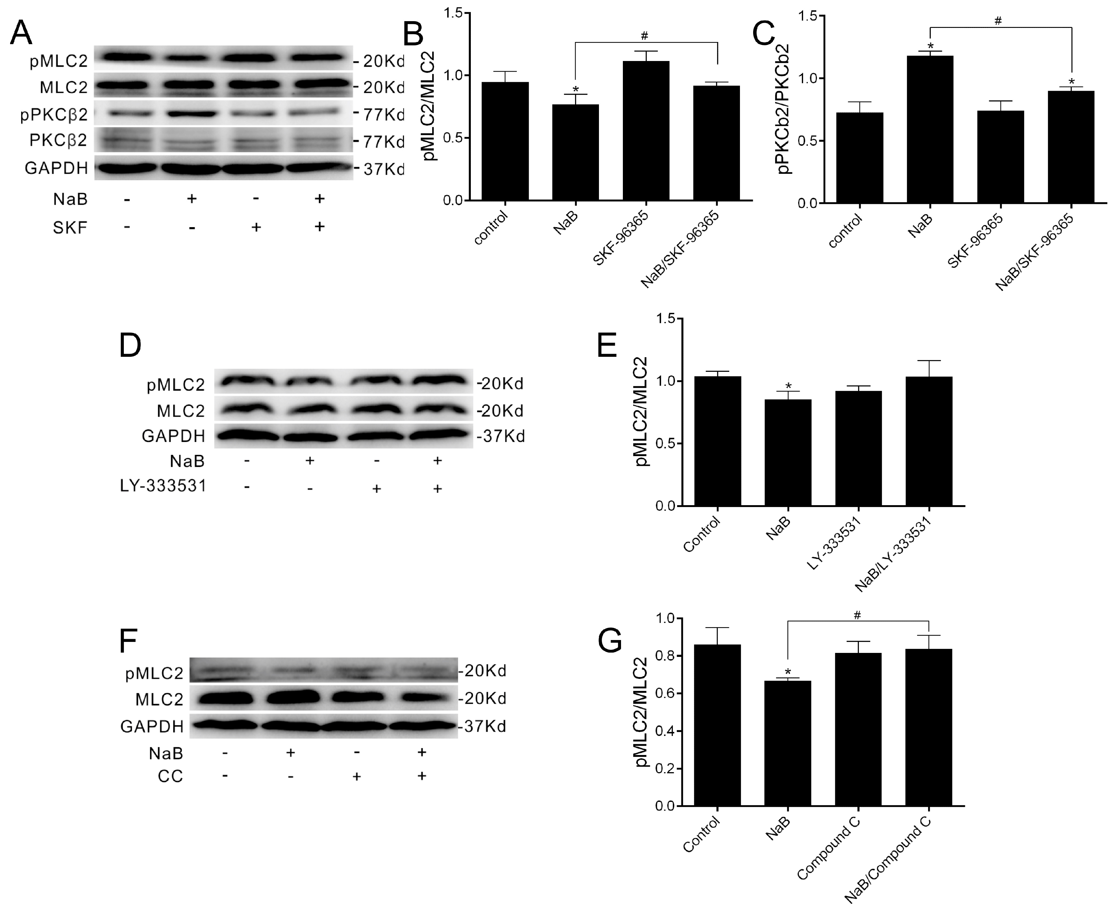 Ijms 17 01696 g004