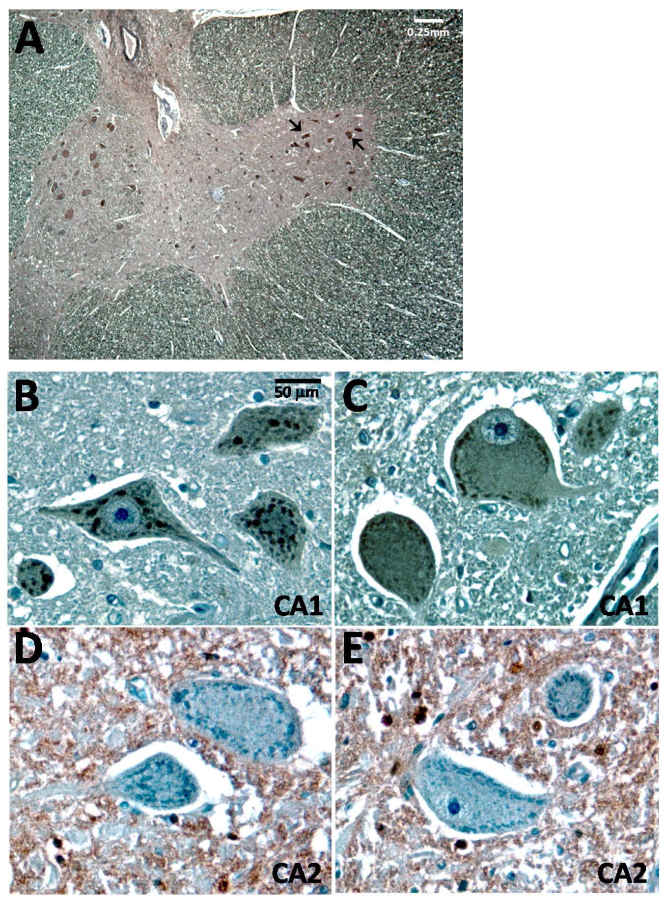 Ijms 17 01820 g001