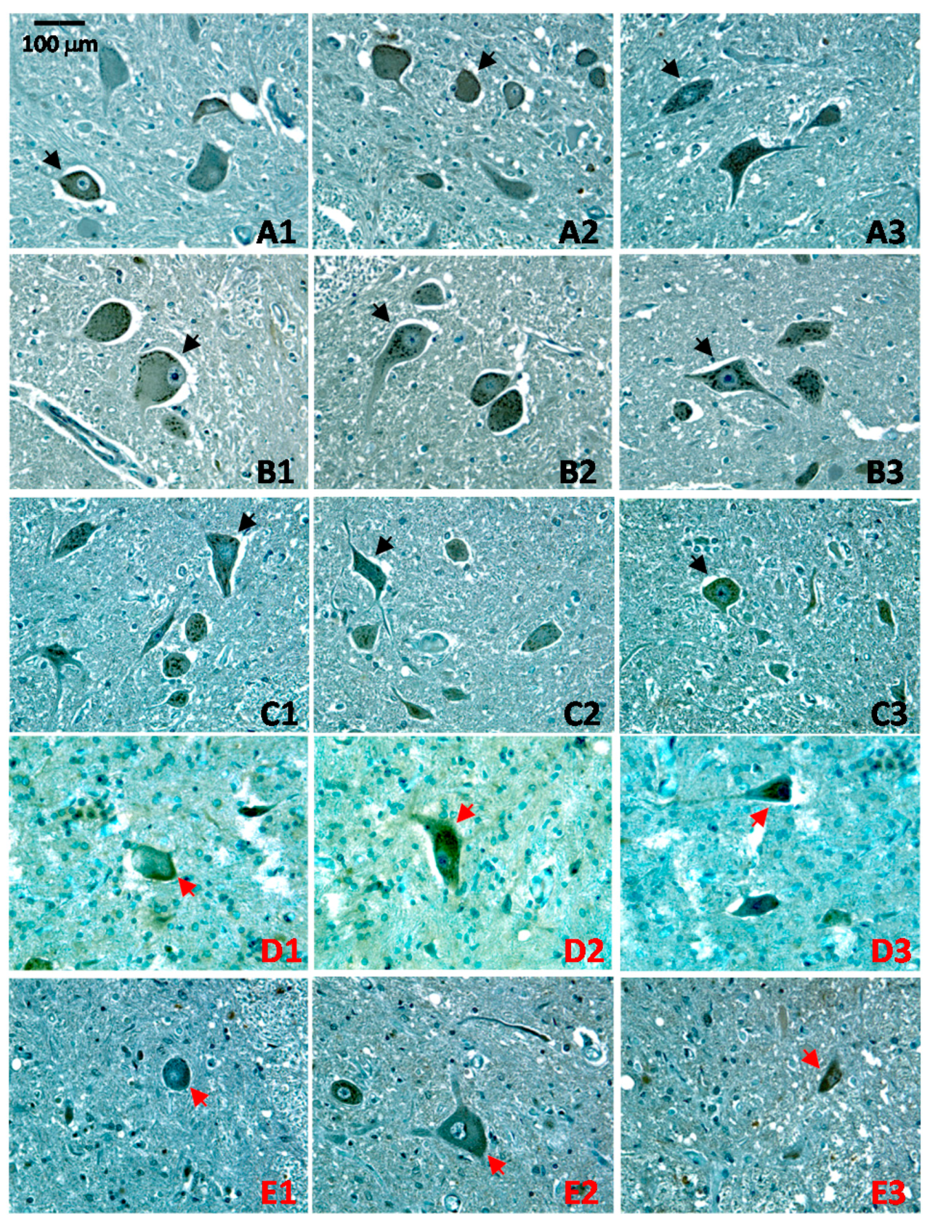 Ijms 17 01820 g004