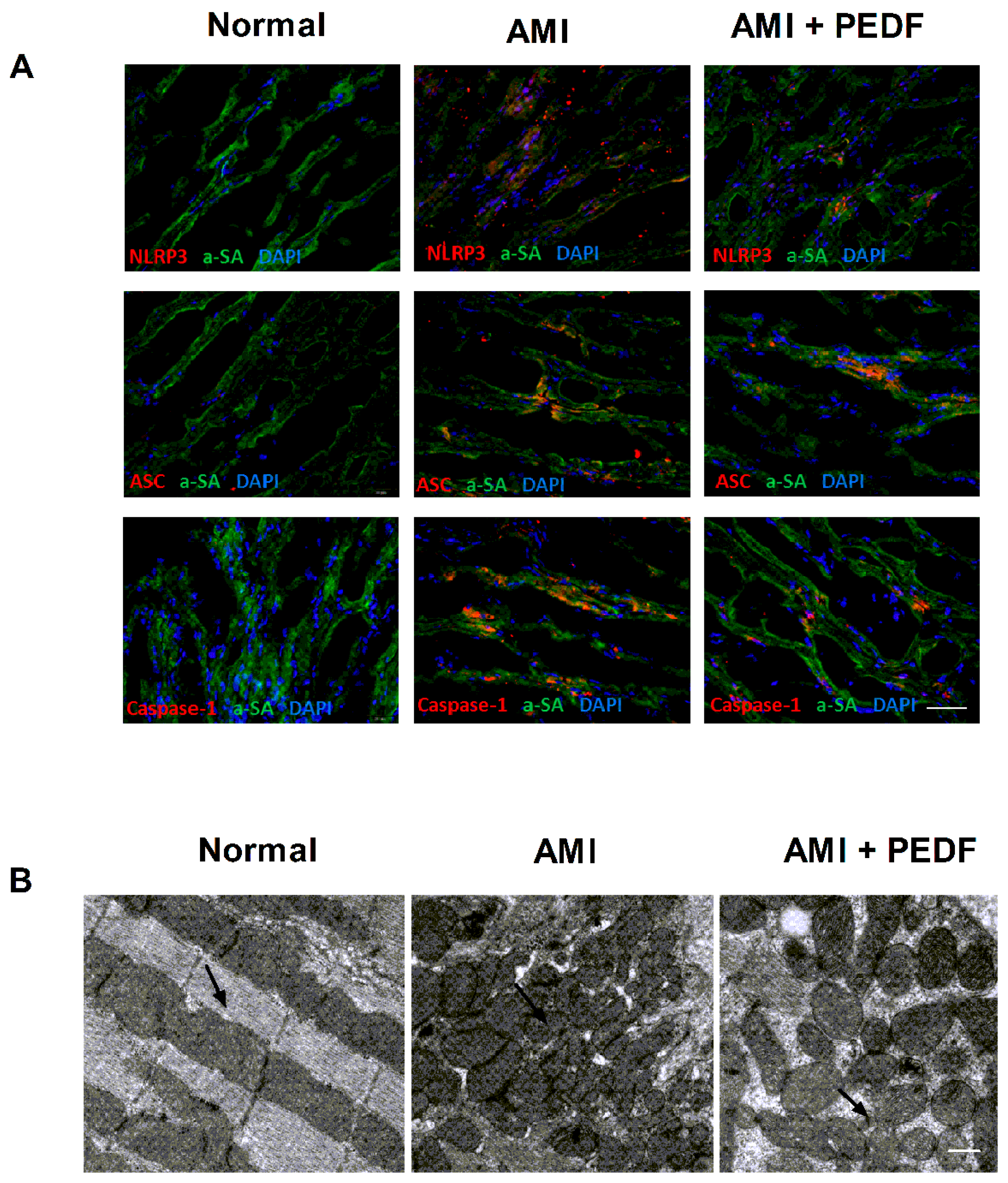 Ijms 17 02064 g001