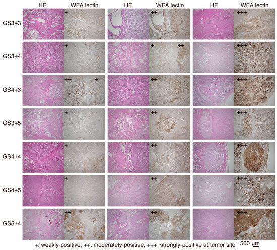 Ijms 18 00261 g007 550