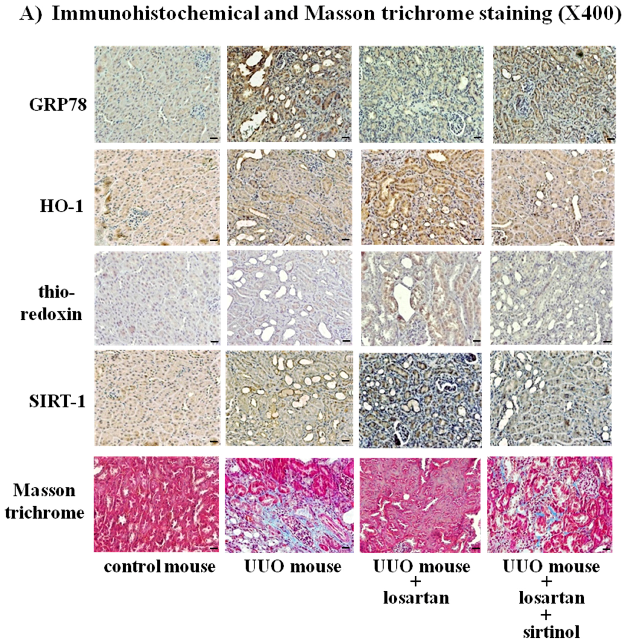 Ijms 18 00305 g008a