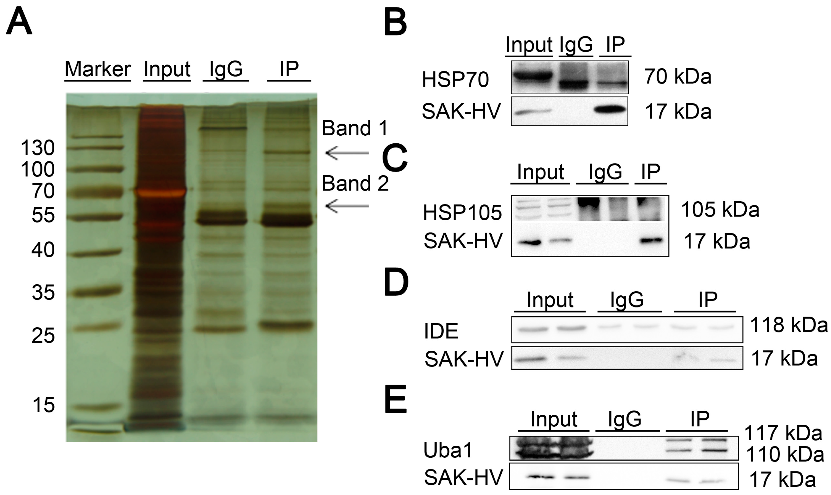 Ijms 18 00835 g009