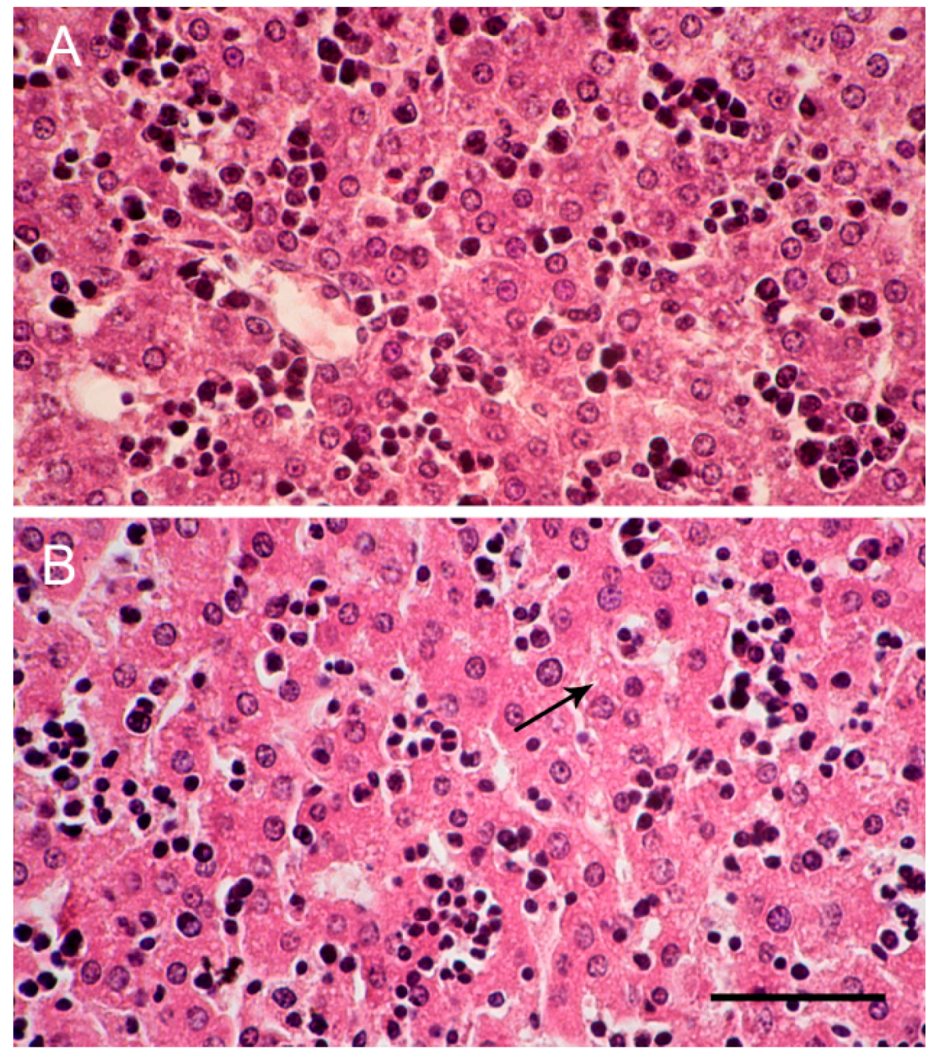 Ijms 18 01098 g003