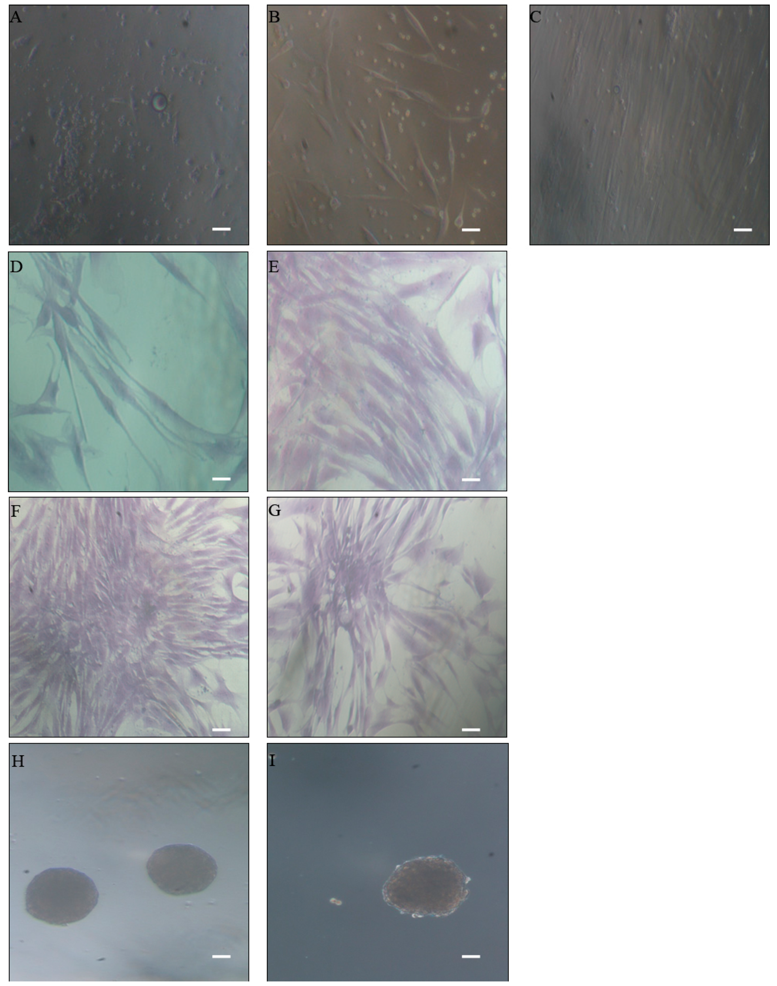 Ijms 18 01107 g001