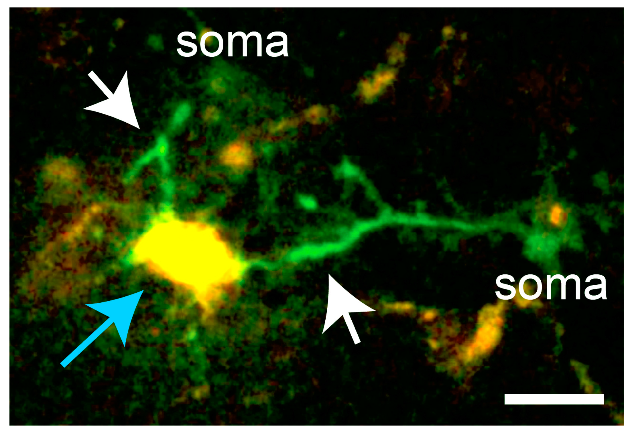 Ijms 18 02366 g003 Ijms 18 02366 g003