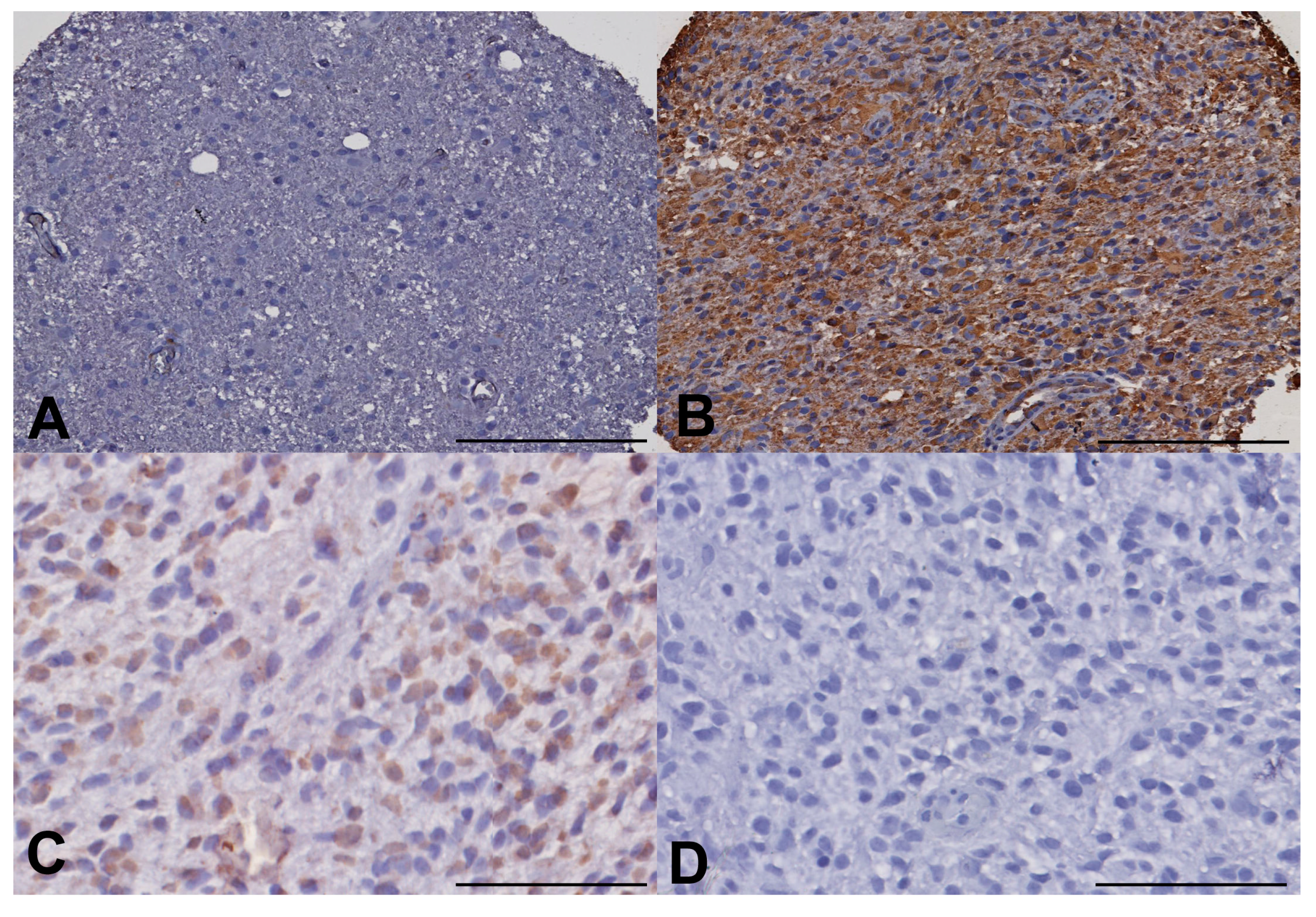 Ijms 18 02452 g004 Ijms 18 02452 g004