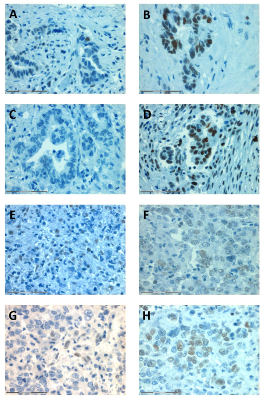 Ijms 19 01421 g004