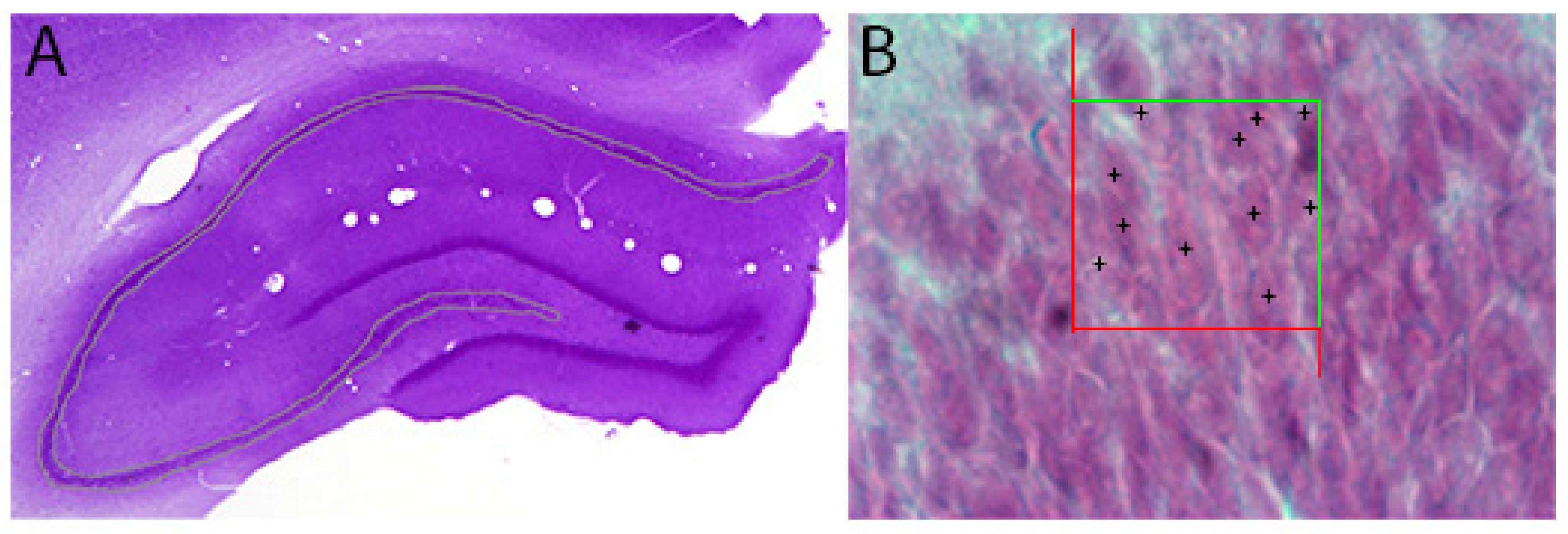 Ijms 19 02461 g010 Ijms 19 02461 g010