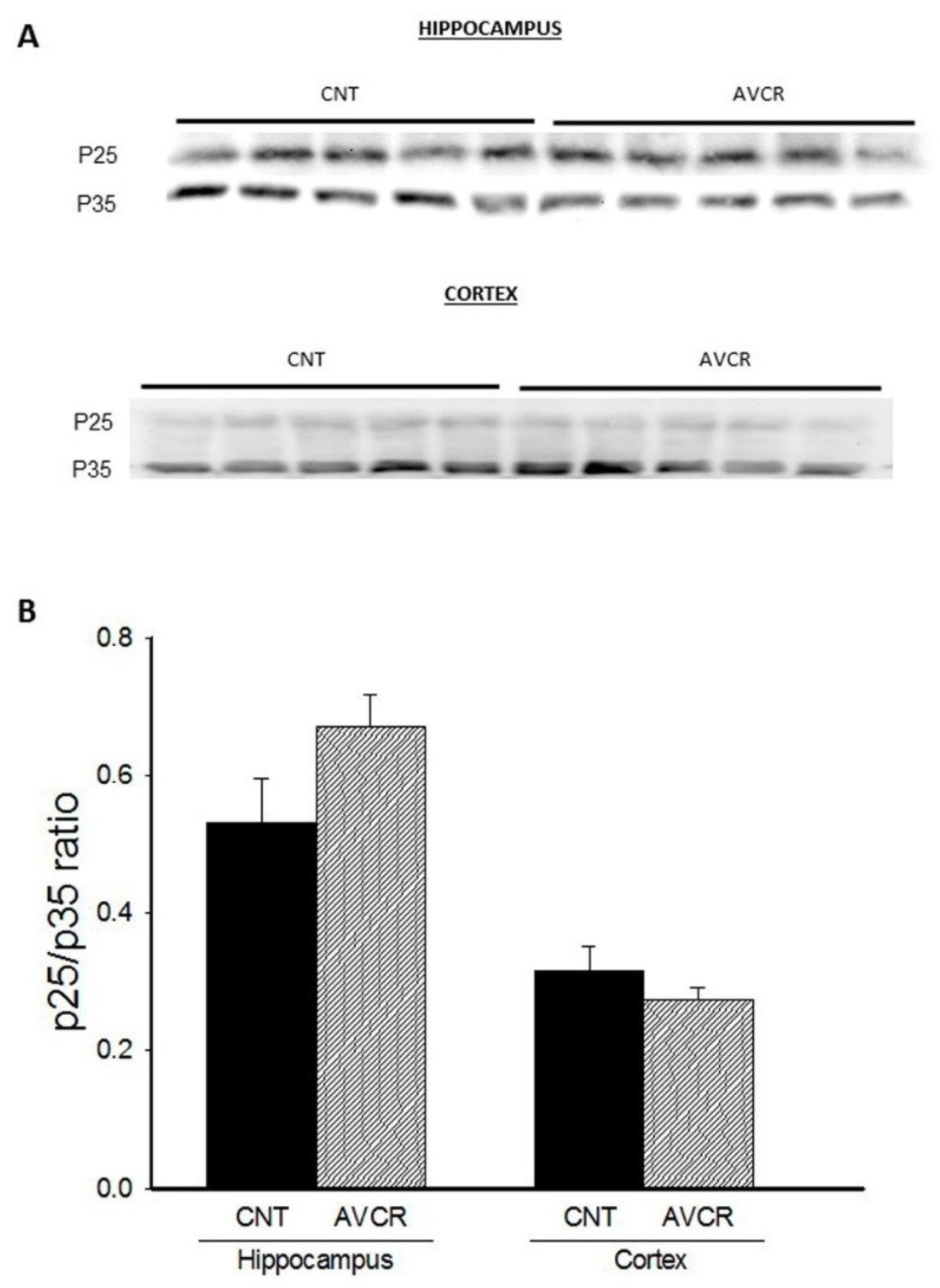 Ijms 19 02615 g004