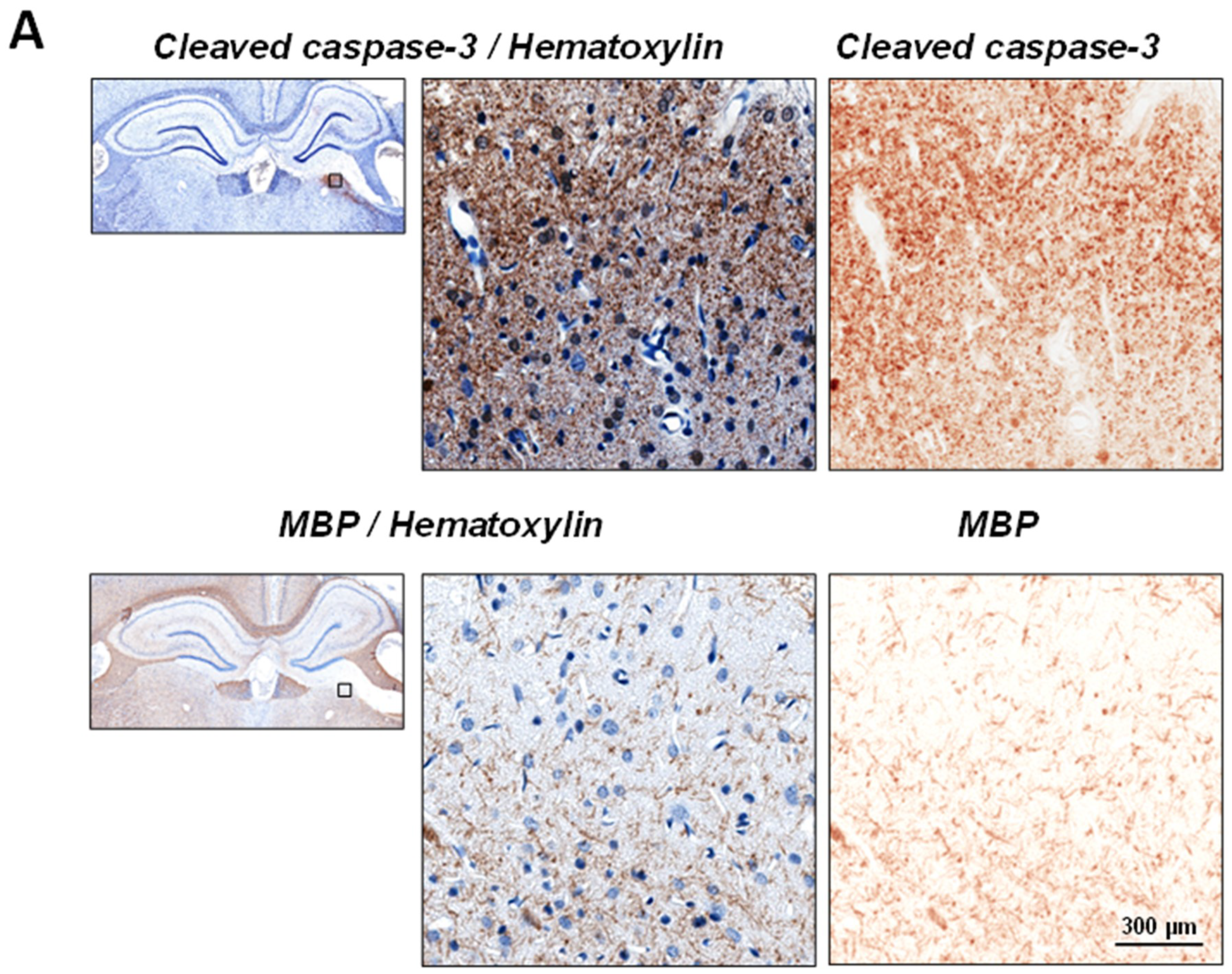 Ijms 19 03151 g003a Ijms 19 03151 g003a