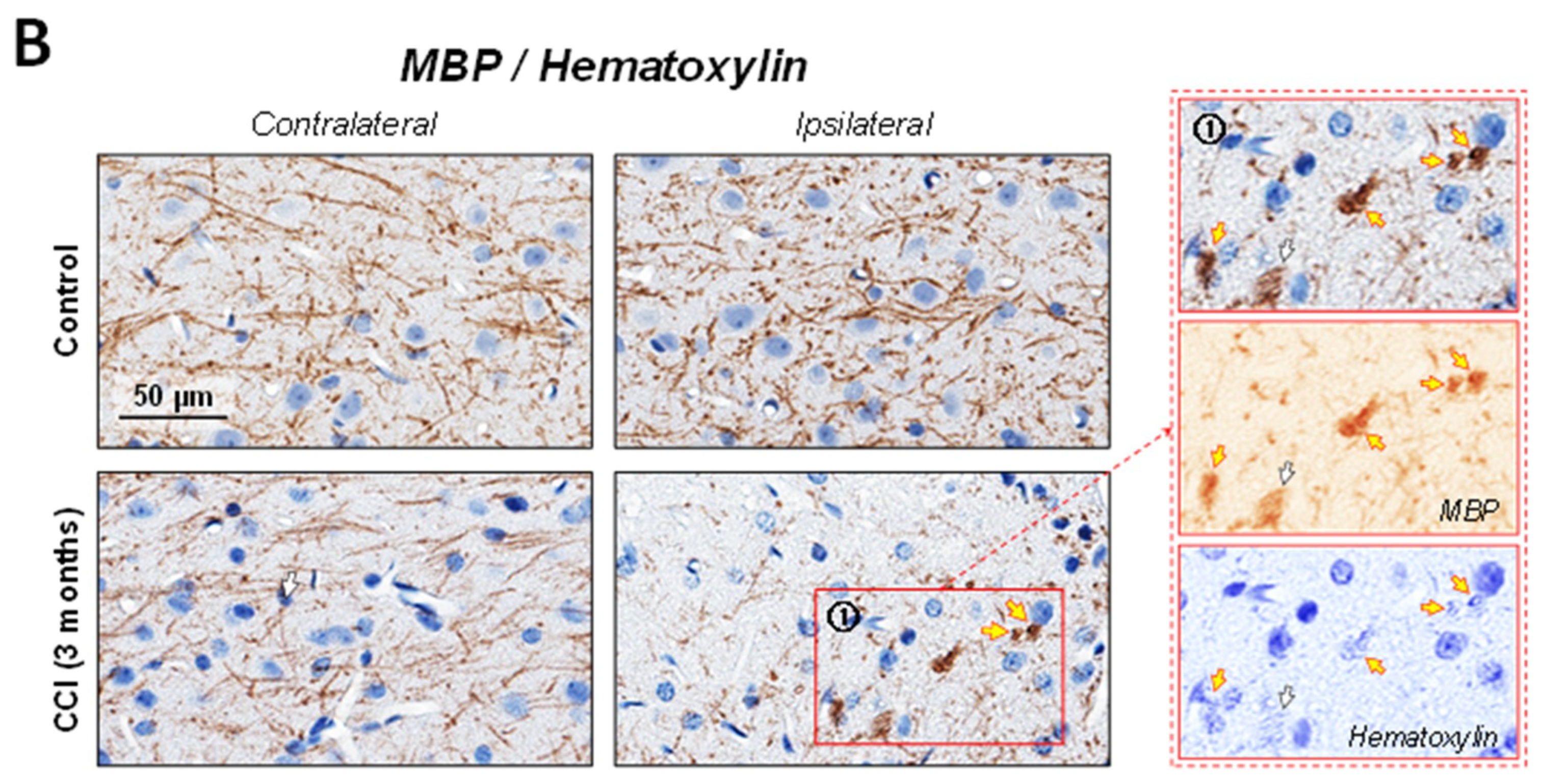 Ijms 19 03151 g003b Ijms 19 03151 g003b