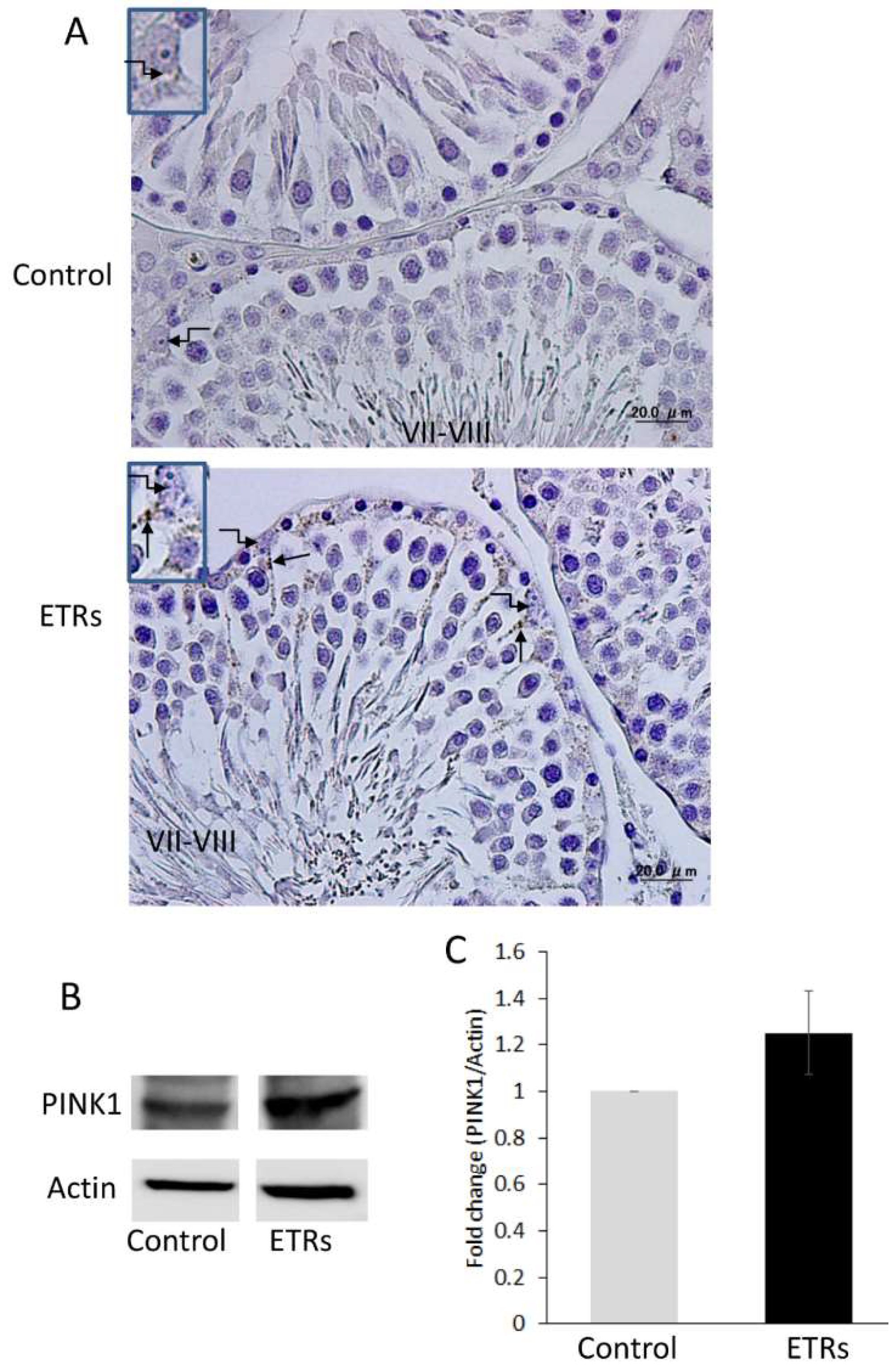 Ijms 20 00184 g007