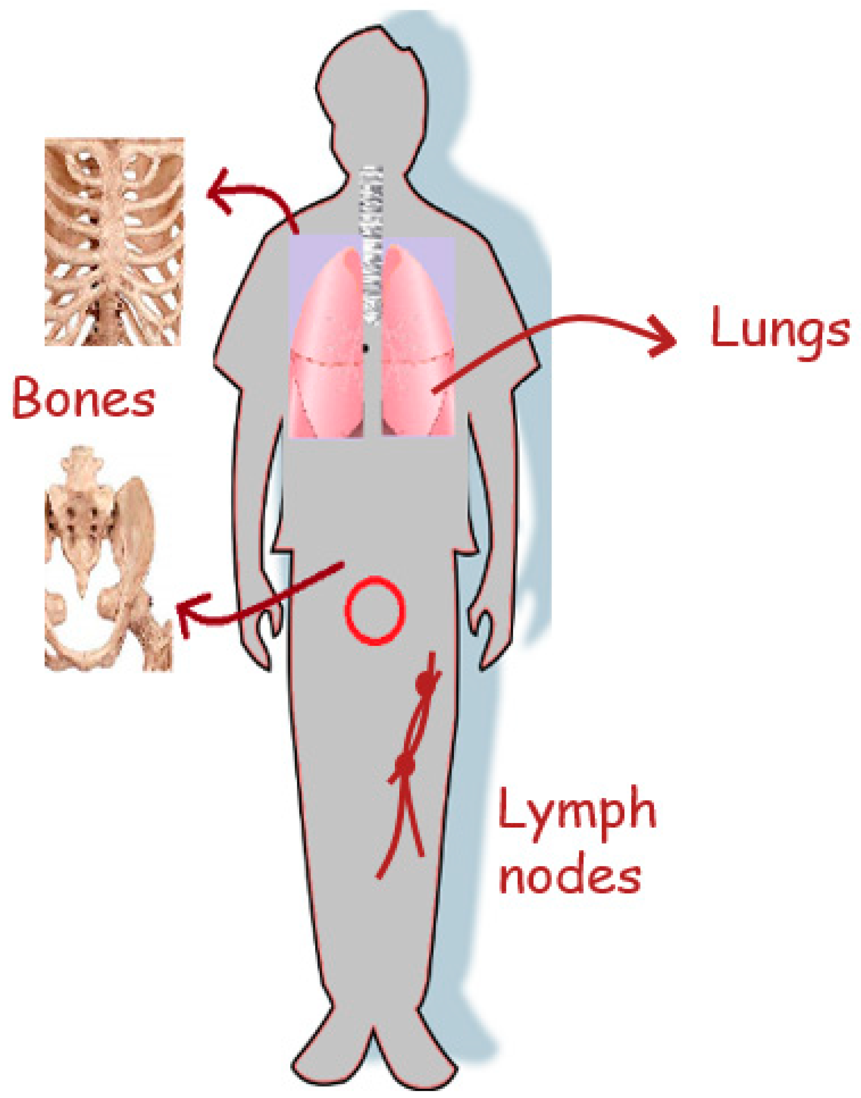 Ijms 20 00970 g001 Ijms 20 00970 g001