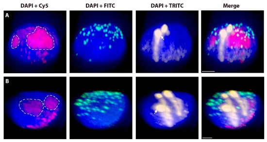 Ijms 20 01448 g0a1 550