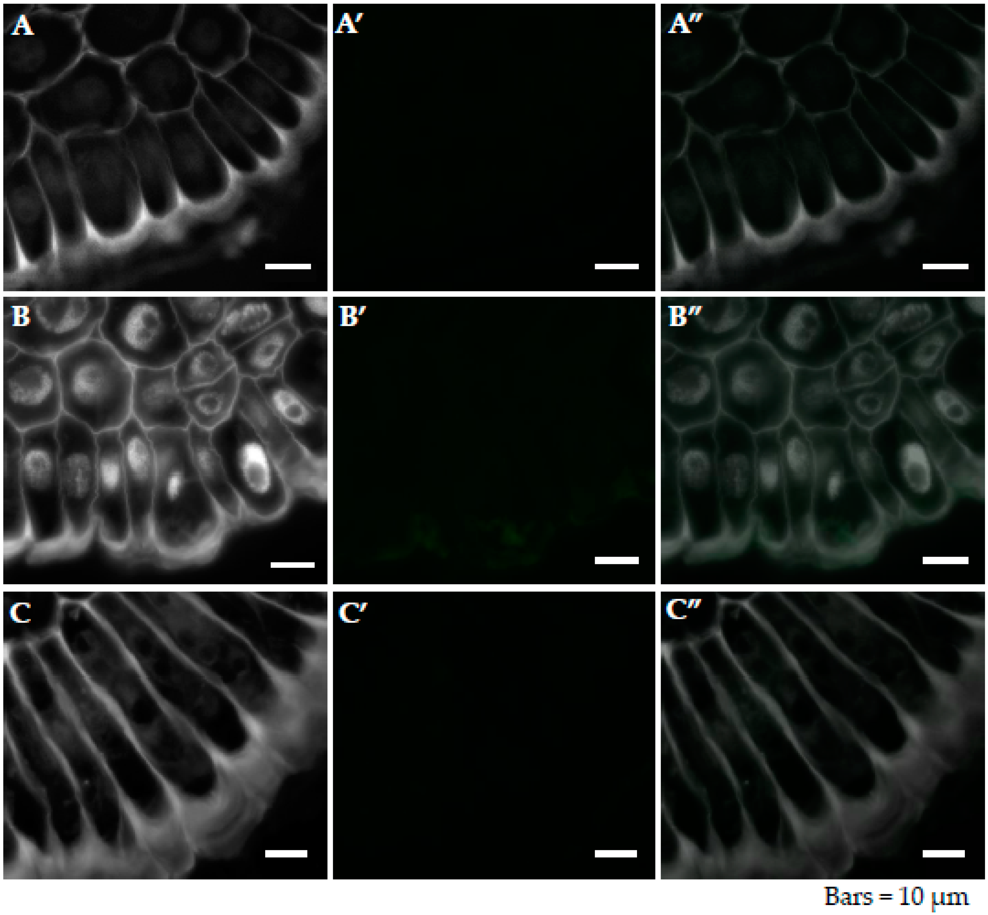 Ijms 20 03039 g0a2 Ijms 20 03039 g0a2