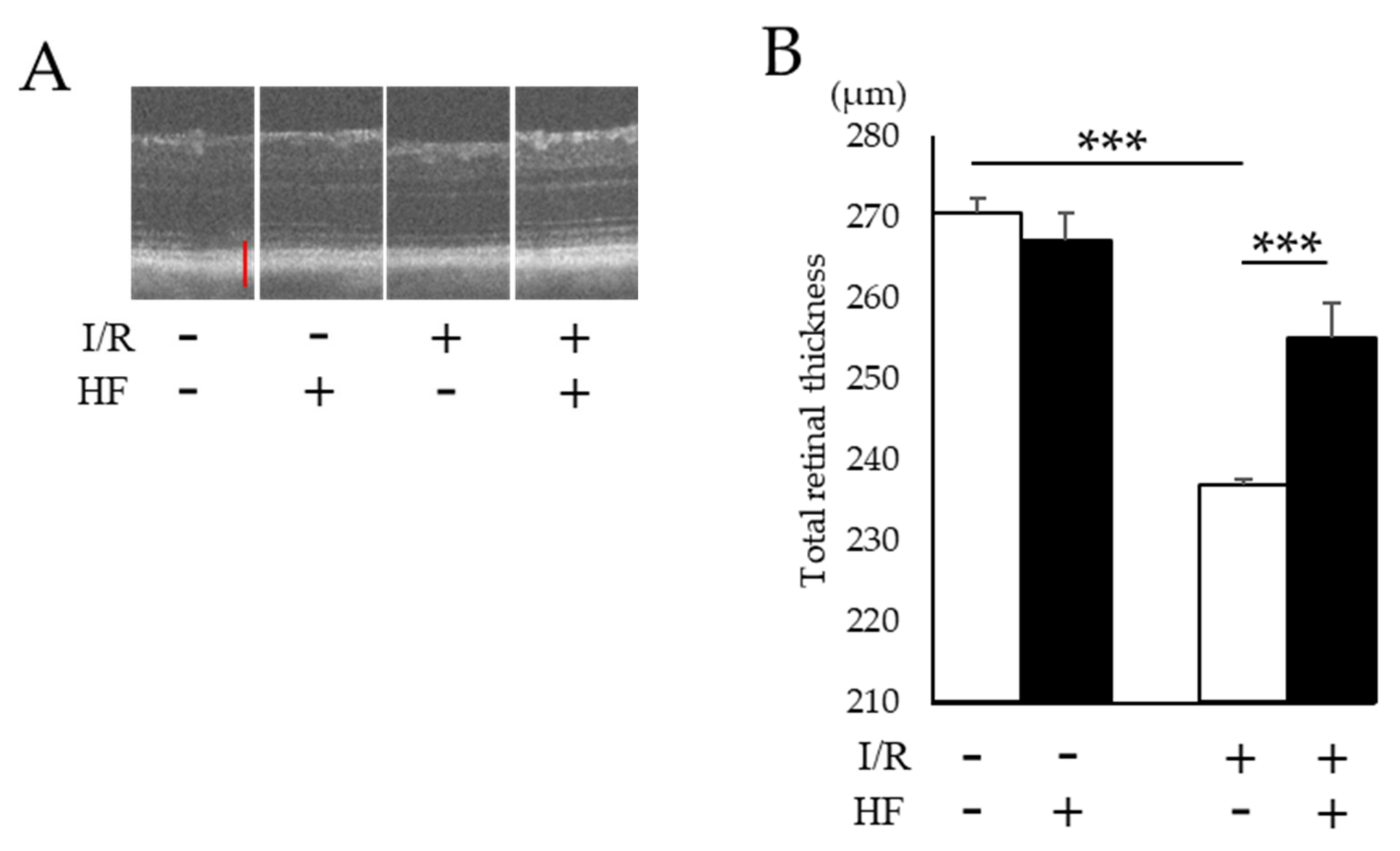 Ijms 20 03171 g004a Ijms 20 03171 g004a