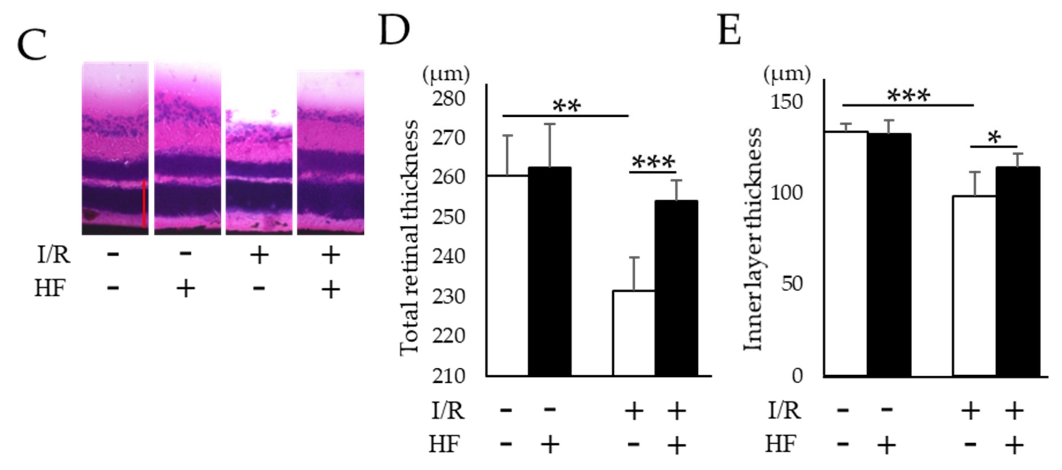 Ijms 20 03171 g004b Ijms 20 03171 g004b