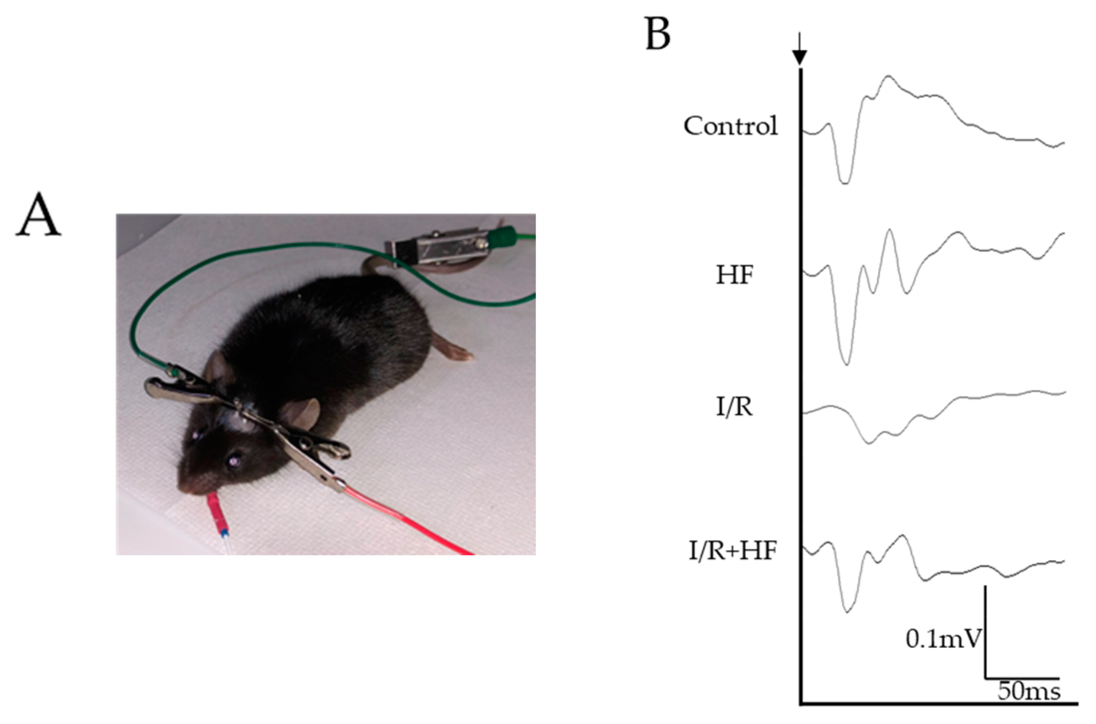 Ijms 20 03171 g007a Ijms 20 03171 g007a