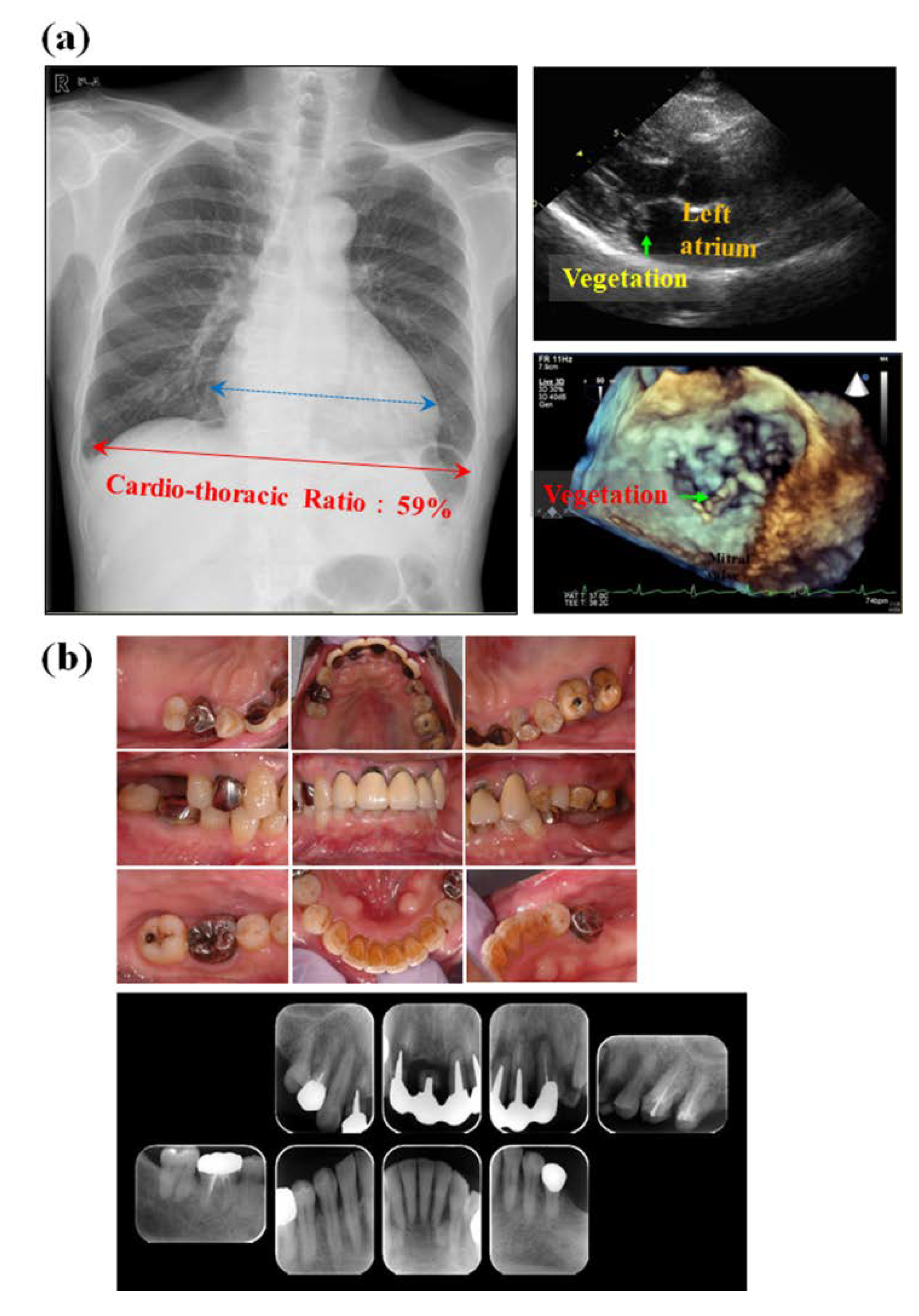 Ijms 20 04571 g003 Ijms 20 04571 g003