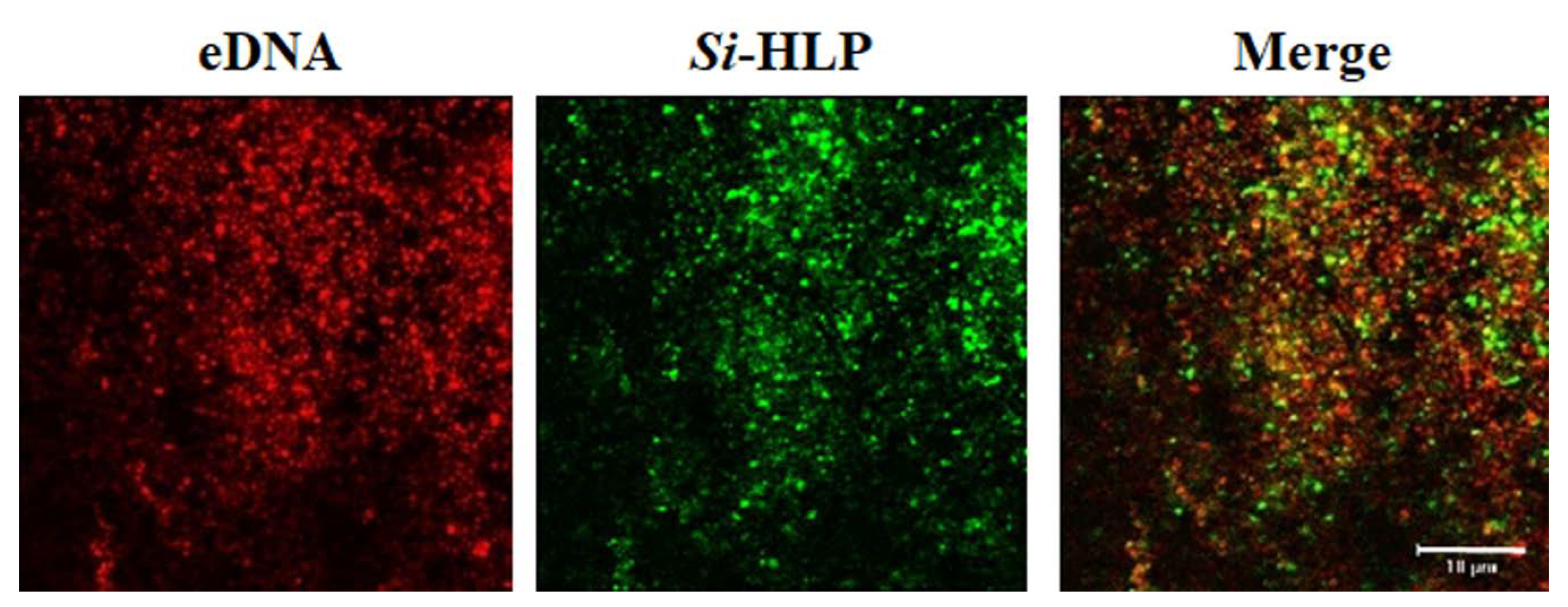 Ijms 20 04571 g004 Ijms 20 04571 g004