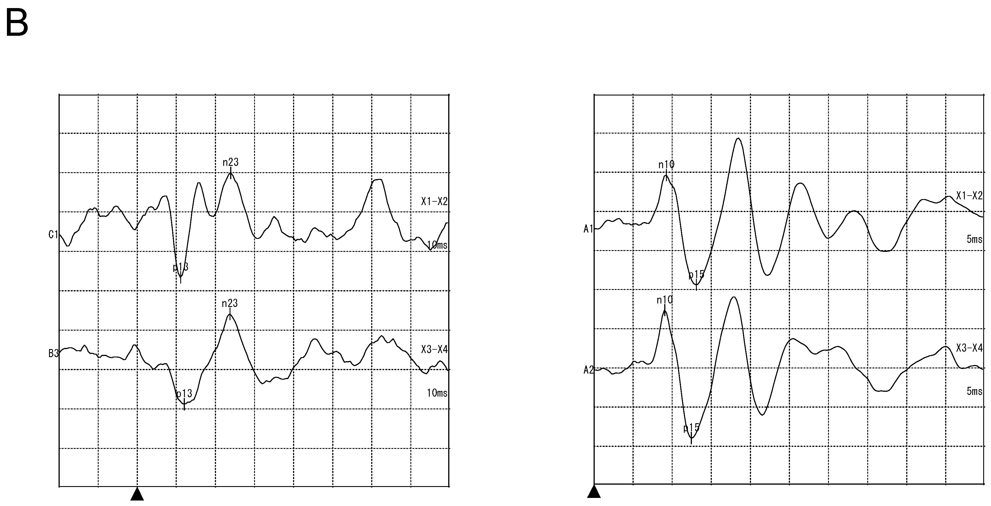 Ijms 20 04579 g003b Ijms 20 04579 g003b