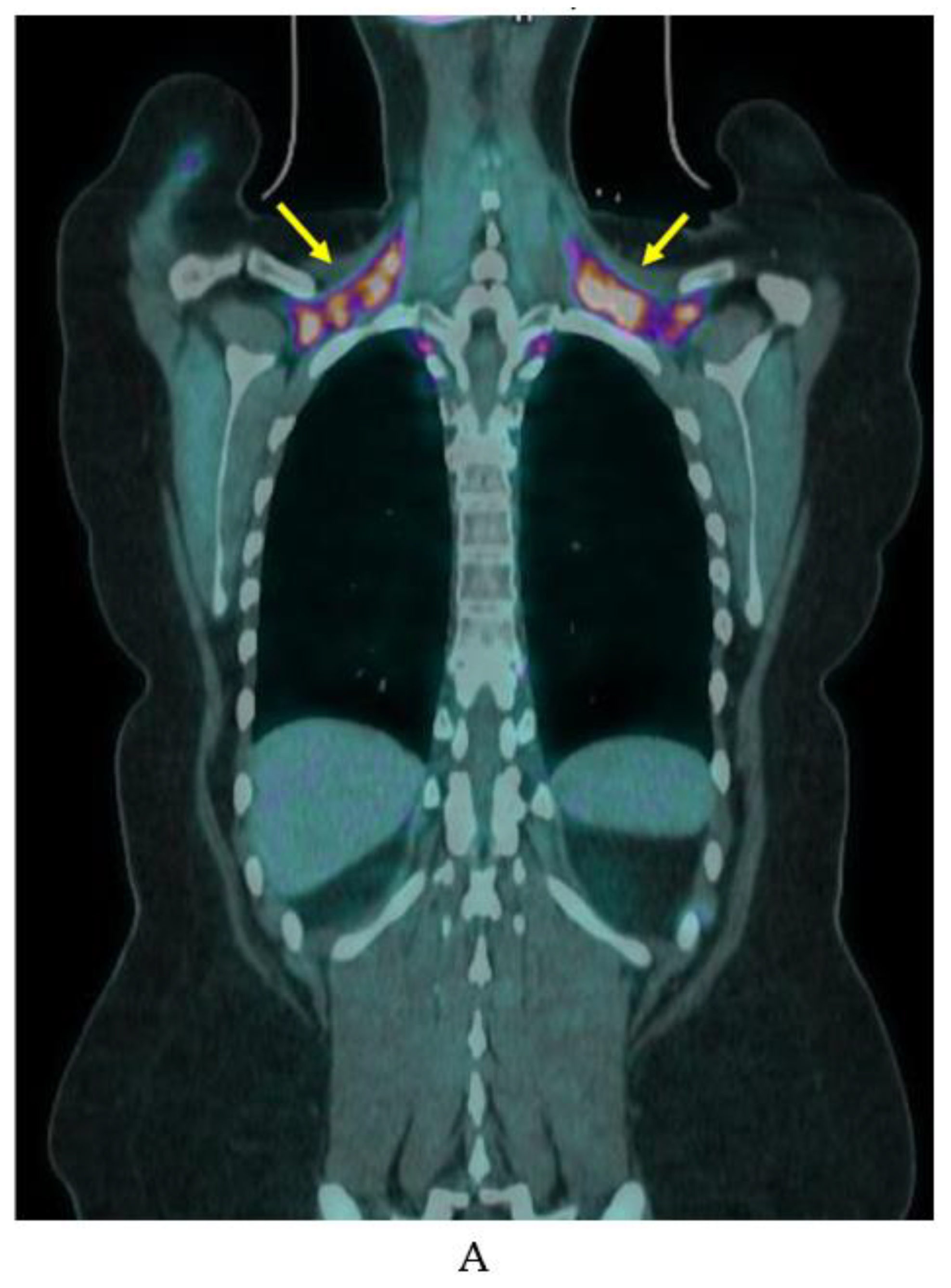 Ijms 20 05509 g005a Ijms 20 05509 g005a