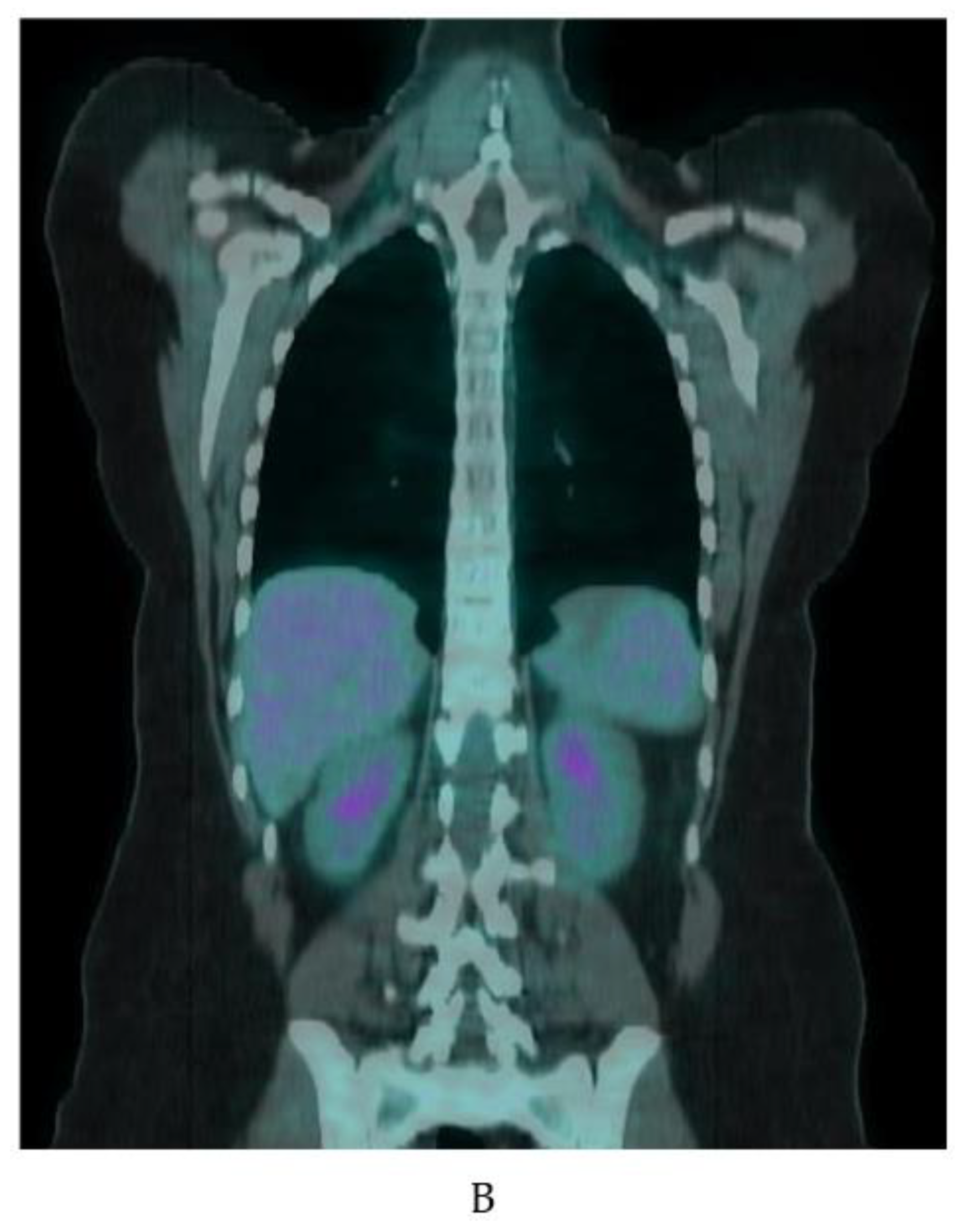 Ijms 20 05509 g005b Ijms 20 05509 g005b